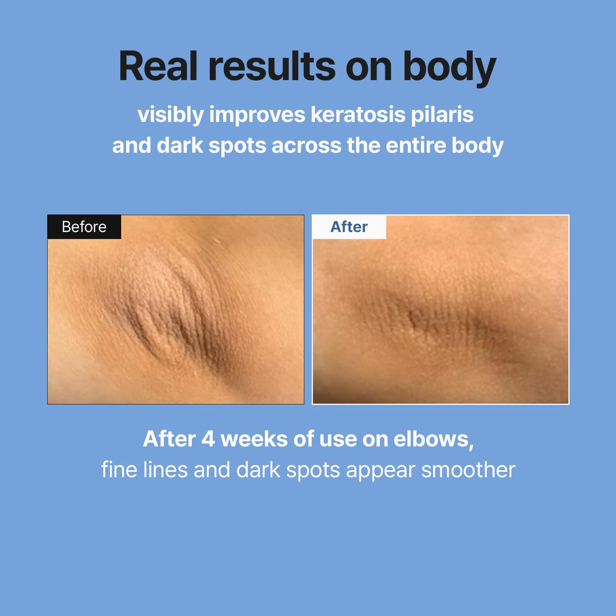 Retinal Skin Booster Serum