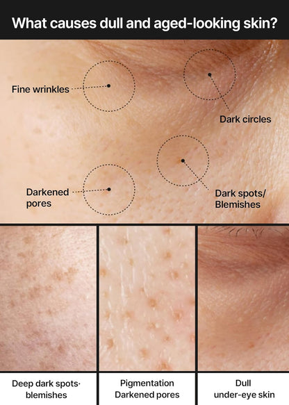 Korean Dark Spot Protocol