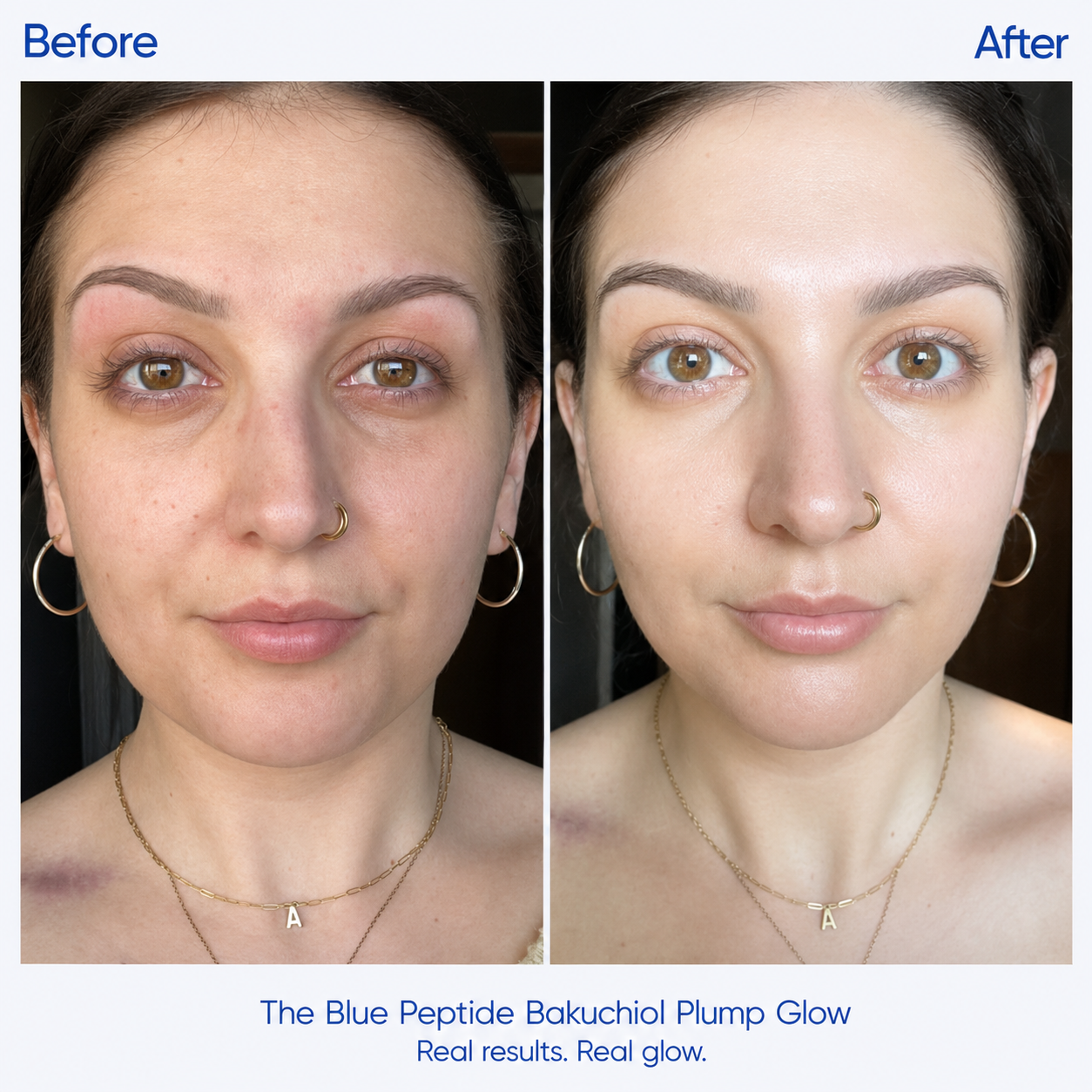 Korean Blue Copper Peptide Bakuchiol Plumping Serum