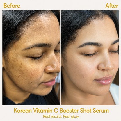 Korean Vitamin C Booster Shot Serum with Glutathione